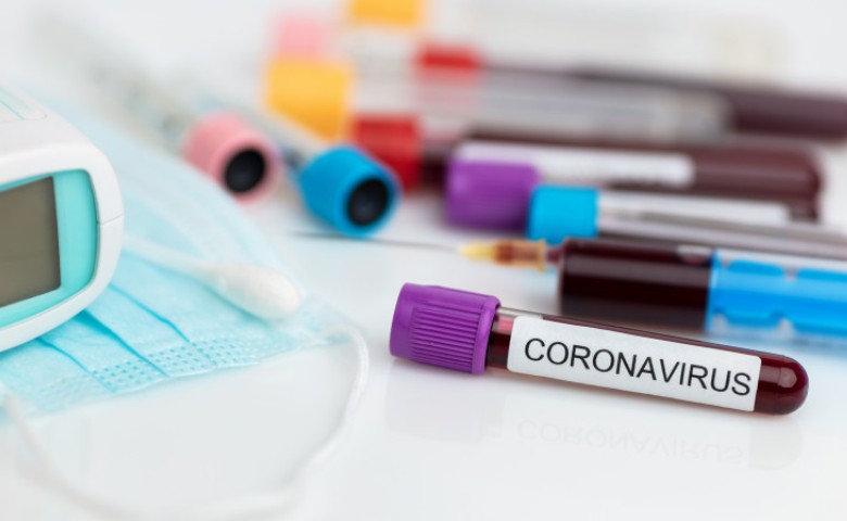 Атырау облысында өткен тәулікте 44 адамда коронавирус індеті ПТР арқылы расталып ауырғаны белгілі болды.
